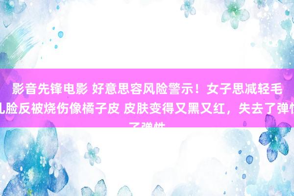 影音先锋电影 好意思容风险警示！女子思减轻毛孔脸反被烧伤像橘子皮 皮肤变得又黑又红，失去了弹性